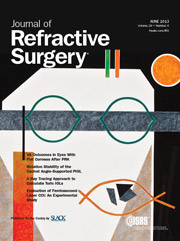 Journal of Refractive Surgery - Junio 2013
