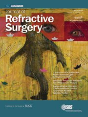 Journal of Refractive Surgery - Julio 2018