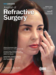 Journal of Refractive Surgery - Agosto 2015